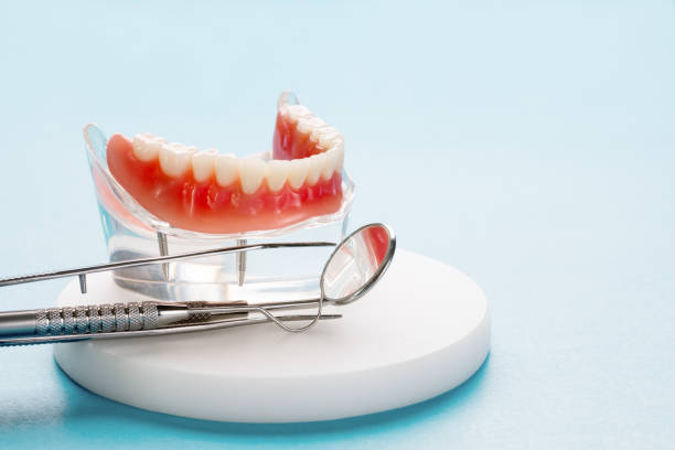 Full Mouth Reconstruction in Taylorsville, NC